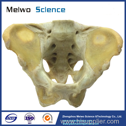 Male pelvis ligament plastinated specimen