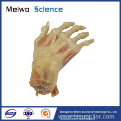 Superficial muscles of hand plastination specimen