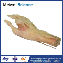 Superficial muscles of hand plastination specimen