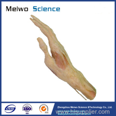 Superficial muscles of hand plastination specimen