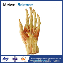 Superficial muscles of hand plastination specimen
