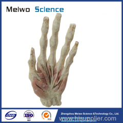 Middle muscle of human hand plastinated specimen