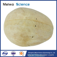 Human scalp level plastinated specimen