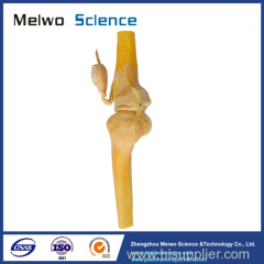 Saggital section of human knee joint plastinated specimen