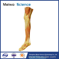 Superficial muscles of lower limb plastinated specimen