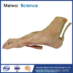 Superficial muscle of foot plastinated specimen