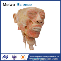 Human head with pharynx plastinated specimen