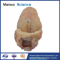 Human tongue specimen plastination