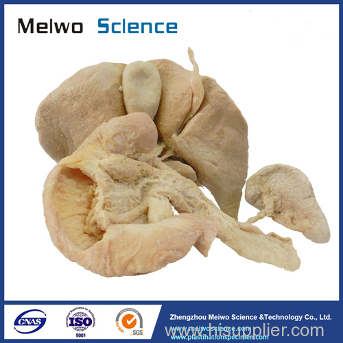 Medical liver pancreas duodenum spleen plastination specimen