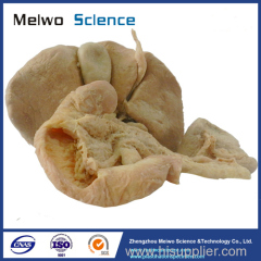 Medical liver pancreas duodenum spleen plastination specimen