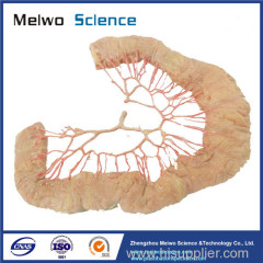 Human ileal vascular arch medical plastinated specimen