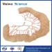 Human ileal vascular arch medical plastinated specimen