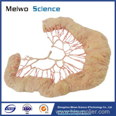 Human ileal vascular arch medical plastinated specimen