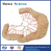 Human ileal vascular arch medical plastinated specimen