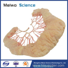 Human ileal vascular arch medical plastinated specimen