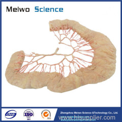 Human ileal vascular arch medical plastinated specimen