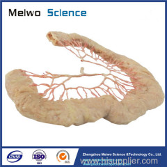 Human jejunal vascular arch plastinated specimen