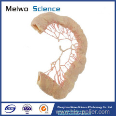 Human jejunal vascular arch plastinated specimen