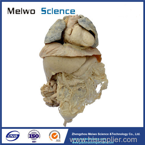 Human viscera plastinated specimen for medical teaching