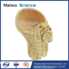 medical pharynx plastinated specimen for sale