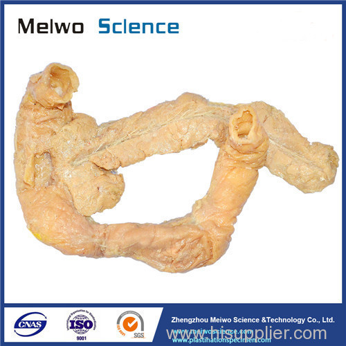 Medical pancreas duodenum plastinated specimen for sale