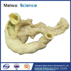 Medical pancreas duodenum plastinated specimen for sale