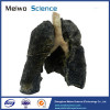 Human smoker lung plastinated specimen for sale
