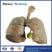 Child lung and larynx medical specimen plastination