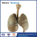 Child lung and larynx medical specimen plastination