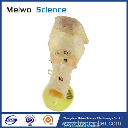 Laryngeal muscle plastination specimen