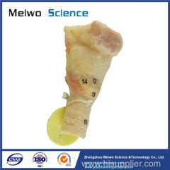Laryngeal muscle plastination specimen