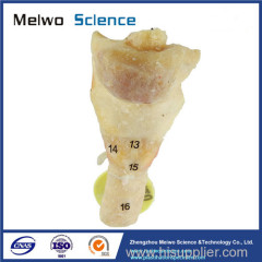 Laryngeal muscle plastination specimen