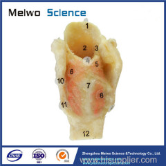 Laryngeal muscle plastination specimen