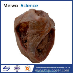 Heart plastinated specimen with ventricles opened to expose the valves