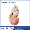 Human whole heart plastinated specimen