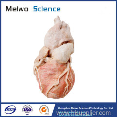 Human whole heart plastinated specimen