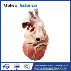 Human whole heart plastinated specimen