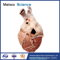 Human whole heart plastinated specimen