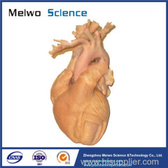 Human whole heart plastinated specimen