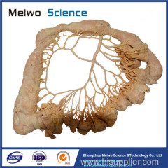 Human inferior mesenteric artery plastinated specimen
