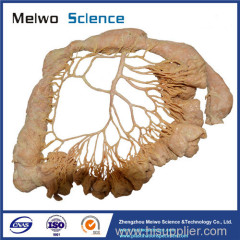 Human inferior mesenteric artery plastinated specimen