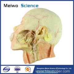 Muscles of neck and carotid plastinated specimen for medical teaching