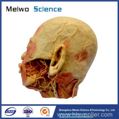 External carotid artery plastinated specimen for medical university