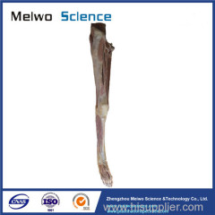 Human artery of lower limb plastinated specimen