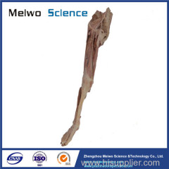Human artery of lower limb plastinated specimen