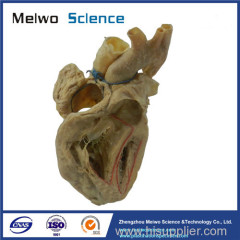 Cardiac conduction system plastination specimen