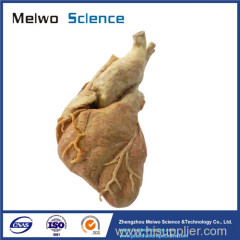 Human cardiac muscle plastinated specimen