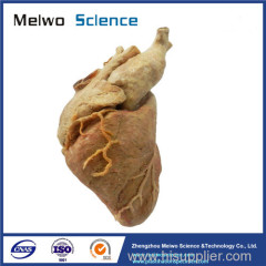 Human cardiac muscle plastinated specimen