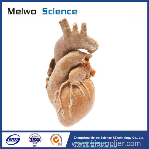 Cardiovascular plastianted specimen for medical anatomy teaching