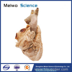 Cardiovascular plastianted specimen for medical anatomy teaching